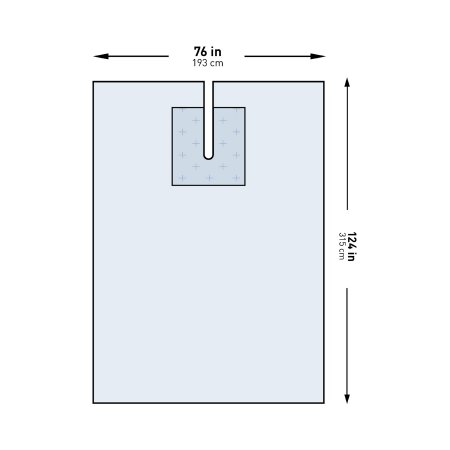 McKesson - EENT Drape EENT Split Drape 76 W X 124 L Inch Sterile - 183-I80-09143G-S