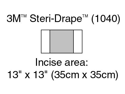 3M Steri-Drape - Surgical Drape Medium Incise Drape 13 W X 13 L Inch Sterile Case of 40 - 1040